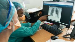 Lääkärit Ilman Rajoja -koronahoitokeskuksen työntekijät tutkivat keuhkokuvaa Cape Townissa, Etelä-Afrikassa kesäkuussa 2020. Kuva: Rowan Pybus.