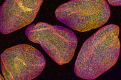 Fluorensoiviksi leimattuja pintasolukon tumia kuvattuna konfokaalimikroskoopilla. Mikroskooppikuvan koko noin 0.03mm x 0.02mm. Kuva: Teemu Ihalainen