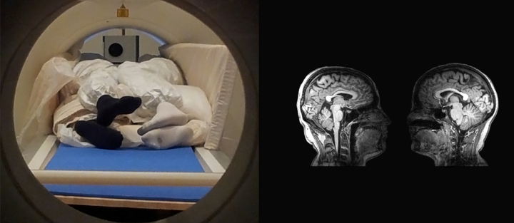 Kuvassa vasemmalla pariskunta magneettikuvauslaitteessa, ja oikealla koskettamiseen liittyvät aivovasteet. Kuva: Ville Renvall.