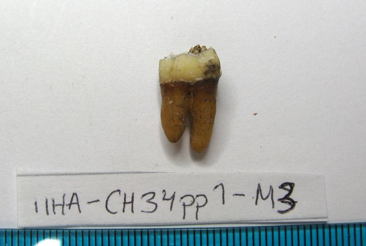 Iin Haminan hautausmaalta löydetyn vainajan hammas (kuva: Maria Lahtinen)