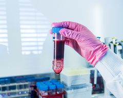 Verenluovuttajien biopankkinäytteiden avulla kehitetään nykyisiä ja tulevia hoitomenetelmiä. Kuva: Noe Anttonen.
