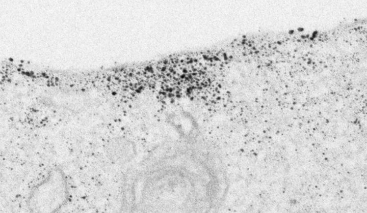 Immunoelektronimikroskopiakuva tau-kasaumista solukalvolla.