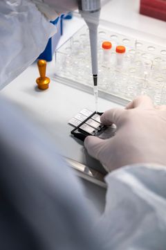 Abacus Diagnostica: Näytteiden analysointia, näytettä pipetoidaan PCR-testilastuun. Kuva: Markus Sommers