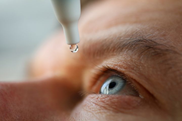 Glaukoomaa hoidetaan alentamalla silmänpainetta silmätipoilla, laserhoidoilla tai leikkauksilla. 
Kuva: iStock.com