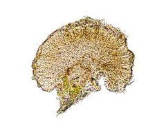 Kuva 2: Poikkileikkaus tyvityynyjäkälän kotelomaljasta, jossa kehittyy monisoluisia itiöitä. Kotelomaljan halkaisija on noin 0,5 mm. (Kuva: Annina Launis)