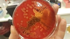 Streptococcus equi ssp. equi -bakteerin kasvu verimaljalla. Kuva: Oona Mäki.