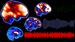 Tutkimusmetodi perustuu aivojen nopeaan toiminnalliseen magneettikuvantamiseen, jonka ansiosta raakasignaalista saadaan eroteltua pulsaatioita edustavat signaalit (vihreä viiva vasomotorinen aalto, sininen viiva hengityksen aiheuttama ja punainen viiva sykkeen aiheuttama osasignaali). Kuva: Matti Järvelä

 