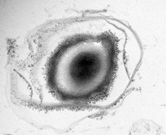 Clostridium botulinum –bakteerin itiö. Kuva: David Kirk
