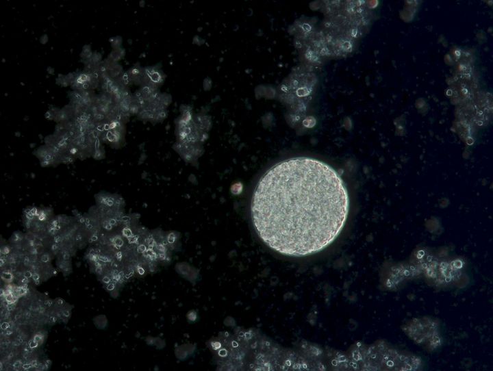 Toksoplasma gondii. Kuva: Pikka Jokelainen