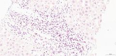 Maksan soluissa näkyvät punaiset pisteet ovat merkkejä viruksista. Kuva: Virus infections and immunity -tutkimusryhmä