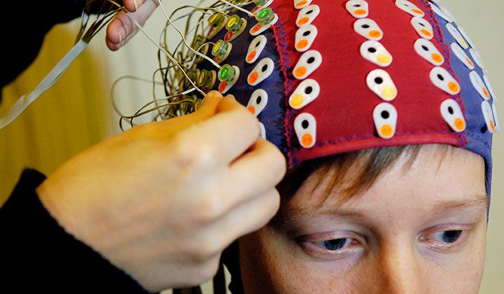 EEG (elektroencefalografi) mäter hjärnans aktivitet via elektroder som fästs i hårbotten. Foto: Veikko Somerpuro