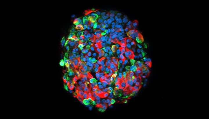 Tutkimusta varten kehitettiin uusia menetelmiä kantasolujen erilaistamiseksi kohti kolmiulotteisia, hormoneja tuottavia soluryppäitä, jotka läheisesti muistuttavat ihmisen haimasaarekkeita. Kuva: Diego Balboa