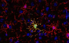 Punaisella näkyvät mikrogliasolut ympäröivät keltaisena näkyvää ARG1-positiivista mikrogliasolua. ARG1-positiiviset mikrogliat osoittautuivat tärkeäksi kognitiivisissa eli tiedollisissa toiminnoissa. Kuva: Vassilis Stratoulias