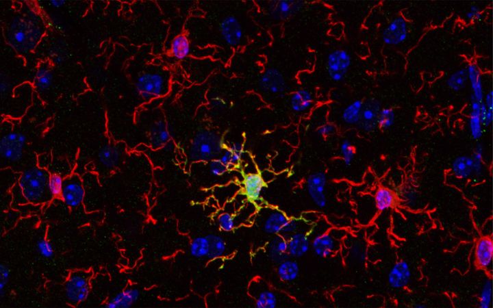 Punaisella näkyvät mikrogliasolut ympäröivät keltaisena näkyvää ARG1-positiivista mikrogliasolua. ARG1-positiiviset mikrogliat osoittautuivat tärkeäksi kognitiivisissa eli tiedollisissa toiminnoissa. Kuva: Vassilis Stratoulias