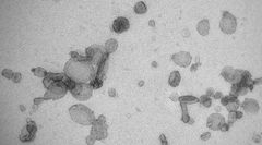 Solunulkoisia vesikkeleitä kuvattuna elektronimikroskoopilla. Kuva: Biocenter Oulu, Electron Microscopy Core Facility.
