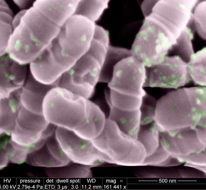 Elektronimikroskooppikuvassa näkyy kuolleita Streptococcus mutans –bakteereja, ja niiden pintarakenteisiin tarttunutta valoherkkää ainetta. Kuva: Koite Health