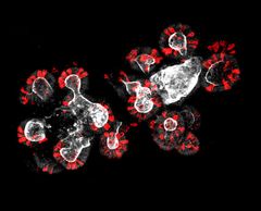 Organoidien eli toiminnallisten minikudosten avulla voidaan tutkia kantasolujen ja naapuri Panethin solujen (punaisella) vuorovaikutuksia. Kuva: Nalle Pentinmikko.