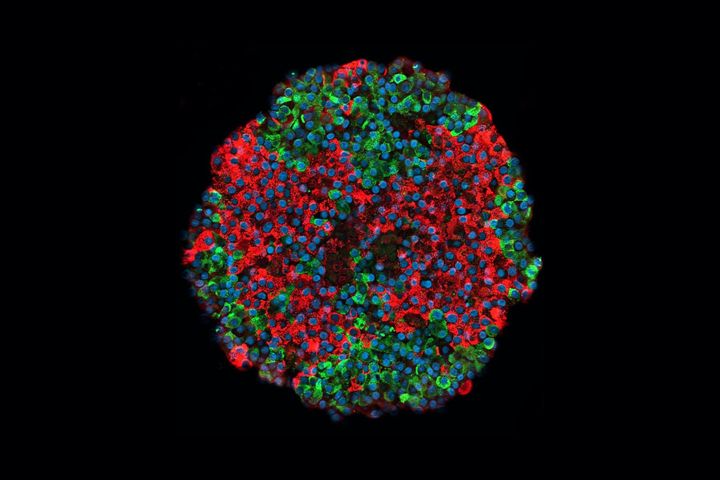 Kuvassa kantasoluista tuotettu haimasaareke. Insuliinia tuottavat solut näkyvät punaisena ja glukagonia tuottavat solut vihreinä. Kuva: Otonkoski Lab