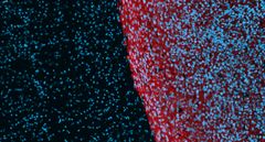 Ihmisen glioblastoomasoluja (punainen) hiirten aivoissa. Klemastiinihoito tuhosi invasiiviset glioblastoomasolut, jolloin kasvainmassan ja terveen aivon rajapinta on selkeä. (Kuva: Laakkonen Lab)