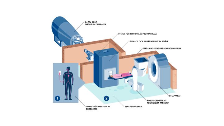 Före bestrålning med neutroner doseras bor bunden till en bärarsubstans i patientens blodkärl. Bärarsubstansen transporterar boren till cancercellen. Överst på bilden partikelacceleratorn som producerar protonstrålen, i mitten polen som omvandlar protonerna till neutroner och ett system för riktning av strålen och nederst på bilden behandlingsrummet där neutronerna riktas mot patientens tumör. I behandlingsrummet finns också utrustning för datortomografi med vilken man kan säkerställa att patienten har rätt position före behandlingen.
