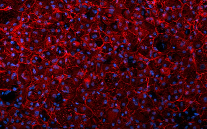 Kuvassa on ihmisen ihon kantasoluja, joista on erilaistettu uusia, maksaa muistuttavia soluja. Erilaistettujen solujen tuottama maksamerkkiaine AFP on värjätty punaisella. Solujen tumien DNA näkyy sinisenä.