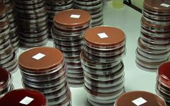 Nenänielunäytteitä Maelan pakolaisleiriltä. Kukin rasia (kasvatusmalja) sisältää yksittäisen näytteen viljelyn tuloksen eli bakteerikasvuston.