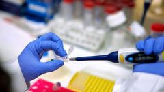 Kaksi hansikoitua kättä työskentelee laboratoriossa pipetin parissa.