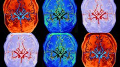 Kuva: Oulun yliopisto