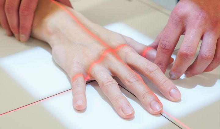Hoitaja asettelee potilaan käden röntgenkuvausta varten.