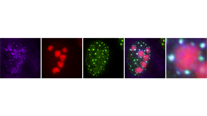 Viruksen lähetti RNA:n kerääntyminen tumatäpliin. RNA FISH -analyysi, joka osoittaa viruksen lähetti-RNA:n sijainnin tumassa infektion aikana. Viruksen lähetti-RNA:n (violetti) sijoittuu tumatäpliin (vihreä) infektoiduissa soluissa, jotka ilmentävät viruksen fluoresoivaa ICP4-proteiinia (punainen).