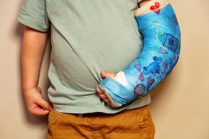 Lasten tapaturmien vakavuus kasvaa Ifin tilastojen perusteella iän mukana, eniten leikkausta vaativia tapaturmia sattuu yli 12-vuotiaille.