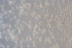 Mikroskooppikuva, jossa näkyy Acanthamoeba castellanii -ameboja eri muotoisina pieninä ryppäinä.