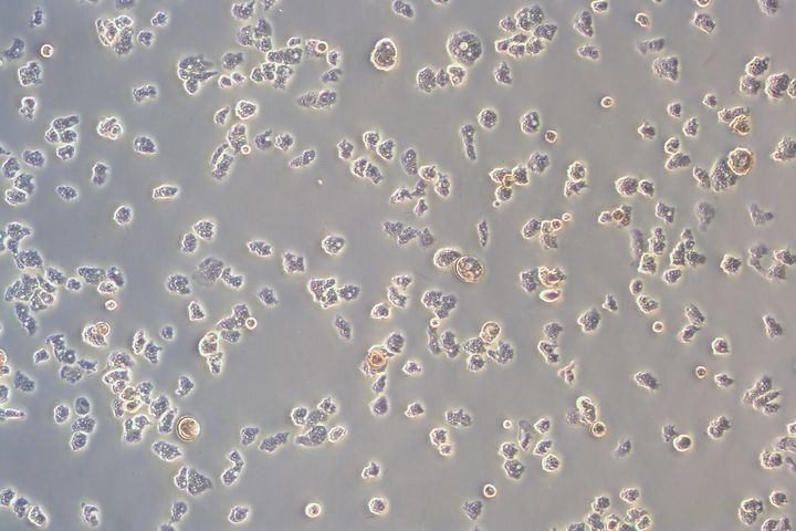 Mikroskooppikuva, jossa näkyy Acanthamoeba castellanii -ameboja eri muotoisina pieninä ryppäinä.