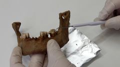 Tutkija käsittelee ihmisen leukaluuta hansikkaat kädessä laboratoriossa.