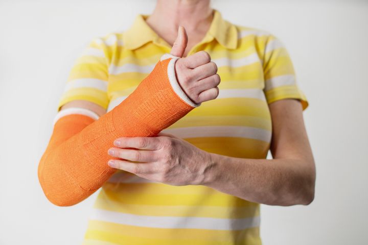 Henkilö, jolla on keltainen raitapaita, pitää kätensä, jossa on oranssi kipsi, peukalo pystyssä.