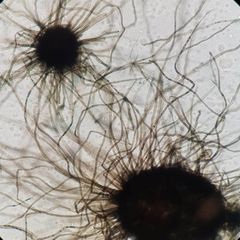 Chaetomium. Askomat voi nähdä jopa paljaalla silmällä, koska ne voivat olla jopa 280 µm pituisia ja karvaisia. Itiökotelot (askukset) kätkevät sisäänsä itiöt. Havaitaan monenlaisissa rakennusmateriaaleissa (mm. puu-, paperi- ja eristemateriaaleissa).