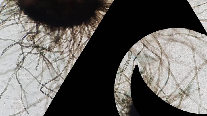 Kuvassa: taustalla näkyy Chaetomium-home.