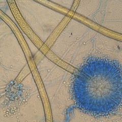 Aspergillus ochraceus. Pesäke pulverimainen ja kauniin keltainen. Melko nopeasti kasvavia pesäkkeitä. Itiökannattimet suoria ja päästä turvonneita. Itiöt kiinnittyvät pallomaiseen vesikkeliin (Aspergilluksille tyypillinen kukkamainen rakenne).