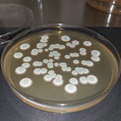 Aspergillus versicolores (lr): Yleisin ns. kosteusvaurioindikaattorimikrobi, joka havaitaan rakennuksissa. Yleinen myös maaperässä, ja todettu myös elintarvikkeissa. DG18-agarilla pesäkkeen erottaa helposti metallinhohtoisesta väristä.