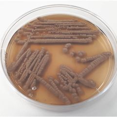 Wallemia sp.: Pesäke pieni rajallinen suklaan ruskea. Havaitaan esimerkiksi huonepölyssä, tekstiileissä, paperissa ja keraamisissa rakennusmateriaaleissa.