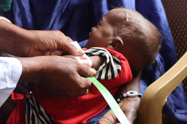 Vauvan olkavarren mittaus terveystarkastuksessa Sudanissa.