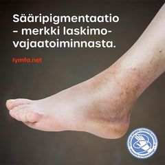 Hoitamaton turvotus aiheuttaa ihomuutoksia kuten pigmentaatiota. Tilanne ei parane itsestään vaan vaatii turvotuksen hoitoa ja kompression käyttöä. Lymfaterapeutilta saat apua ja ohjausta.