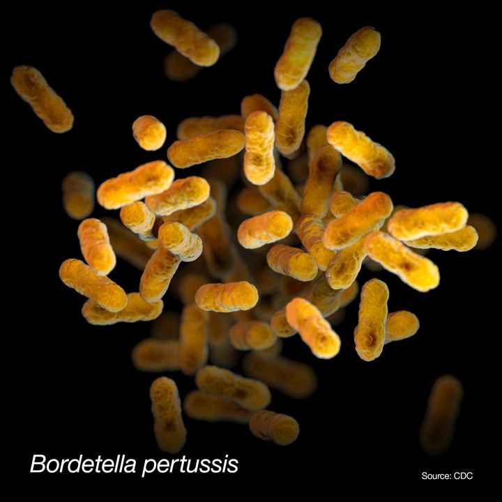 This illustration depicted a three-dimensional (3D), computer-generated image, of a group of aerobic, Gram-negative, Bordetella pertussis bacteria. The artistic recreation was based upon scanning electron microscopic (SEM) imagery. Source Public Health Images.