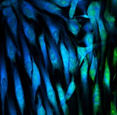 Sinivihreä fluoresenssi/Blue green fluorescence.