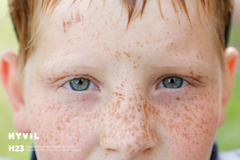 Pisamakasvoinen poika katsoo suoraan kameraan.